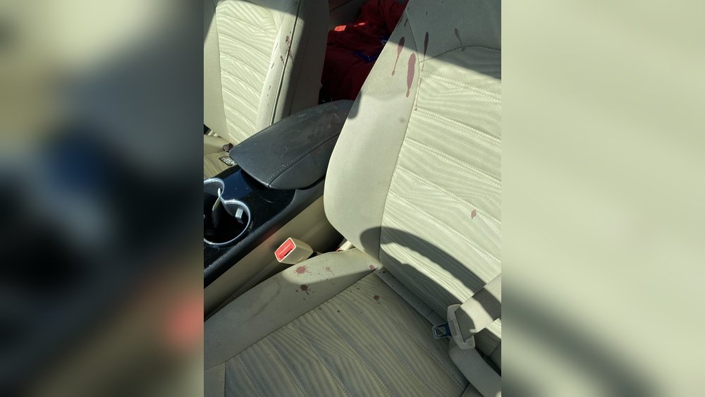 How to Get Blood Out of a Car Seat: Easy & Effective Tips